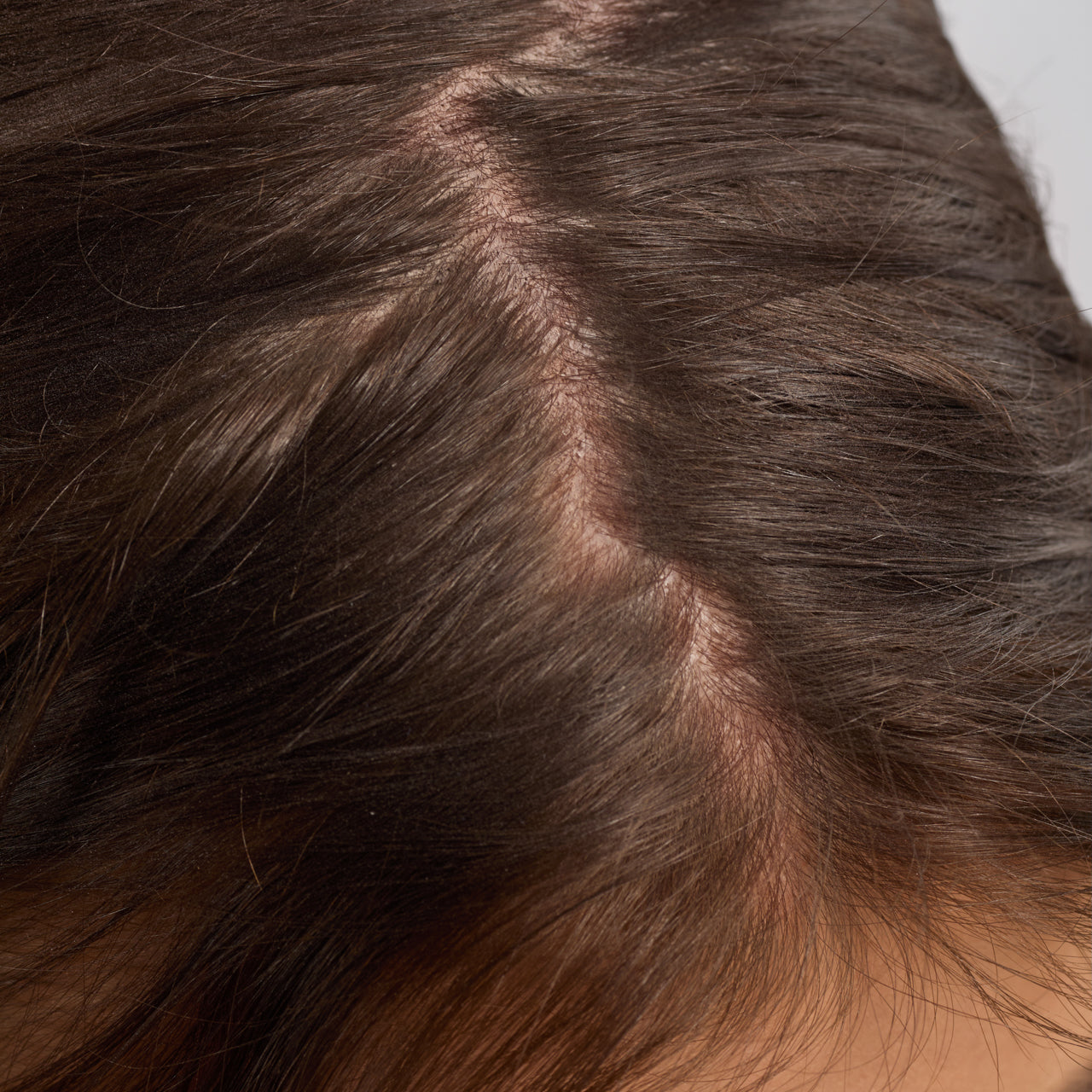 67830-60633-67823-Scalp_HairOilApplicator-Terracotta-Model-Consumables-2-Before-1280x1280px-1.jpg